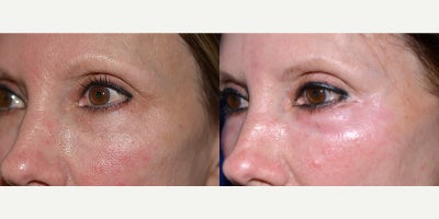 before and after image