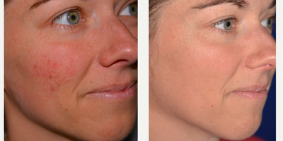 before and after image
