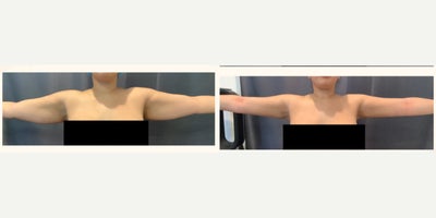 before and after image