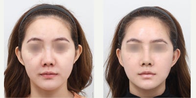 before and after image