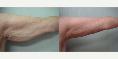 before and after image