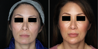 before and after image