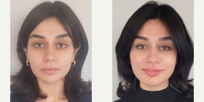 before and after image