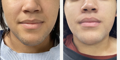 before and after image