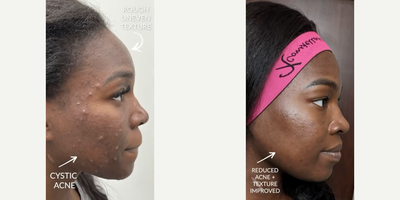 before and after image