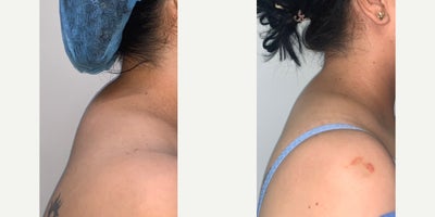 before and after image
