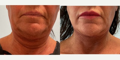 before and after image