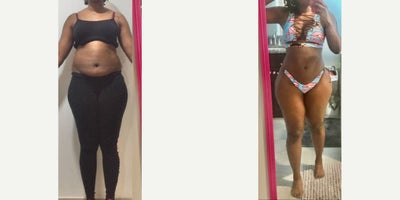 before and after image