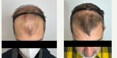 before and after image