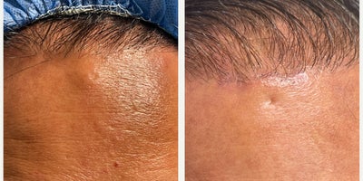 before and after image