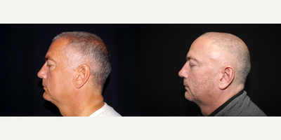 before and after image