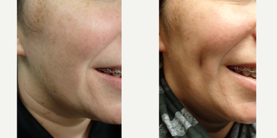 before and after image