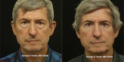 before and after image