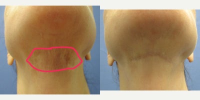 before and after image