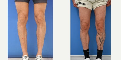 before and after image