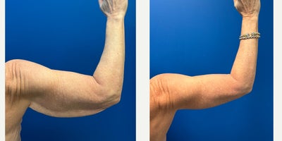 before and after image