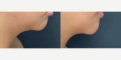 before and after image