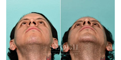 before and after image