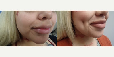 before and after image