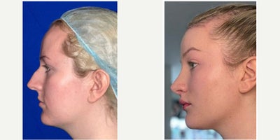 before and after image