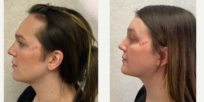 before and after image