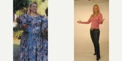 Gastric Bypass before and after photo