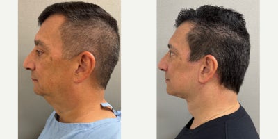 before and after image