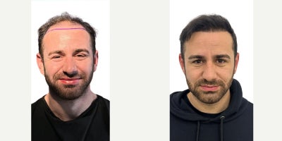 before and after image