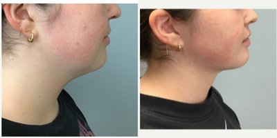 before and after image