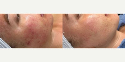 before and after image