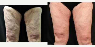 before and after image