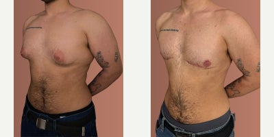 before and after image