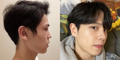 before and after image
