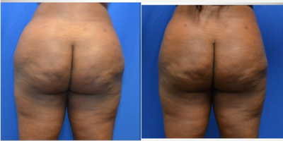 before and after image