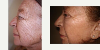 before and after image