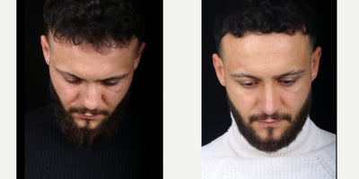 before and after image
