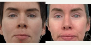 before and after image