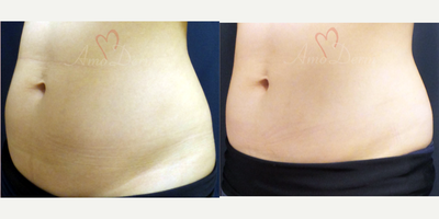 before and after image