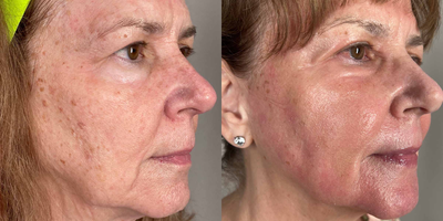 before and after image