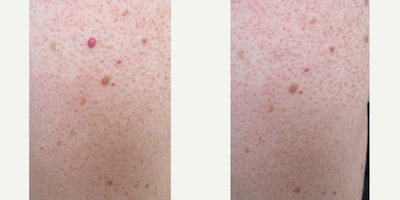 before and after image