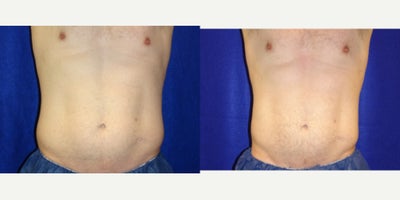 before and after image