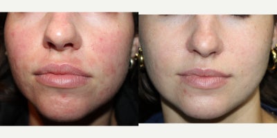 before and after image
