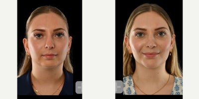 before and after image