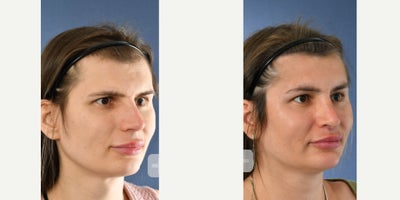before and after image