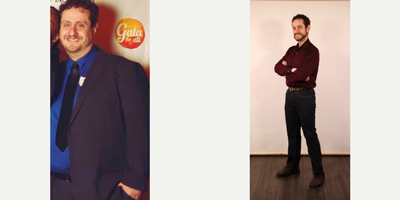 Gastric Sleeve Surgery before and after photo