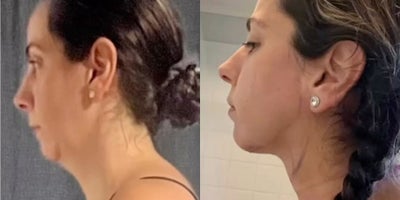 before and after image
