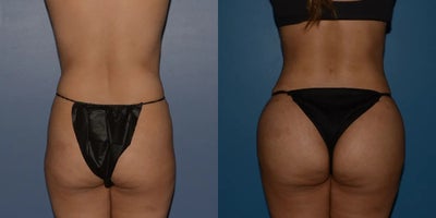 before and after image