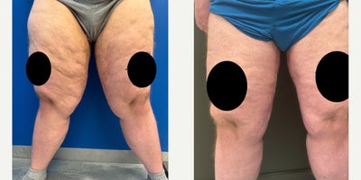 before and after image
