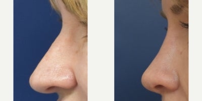 before and after image
