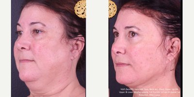 before and after image